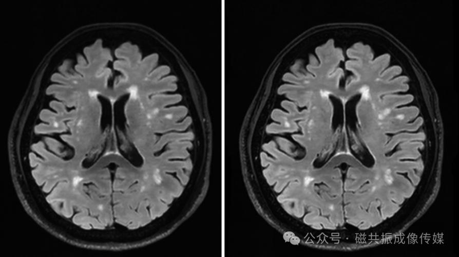 分块压缩感知成像技术如何提升成像效率与质量？-图3