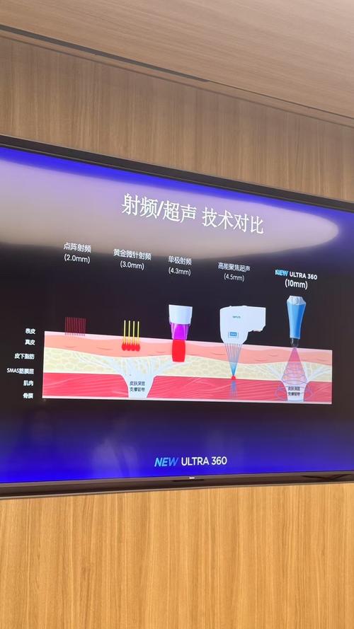 射频技术调试视频讲座，核心要点如何掌握？-图2