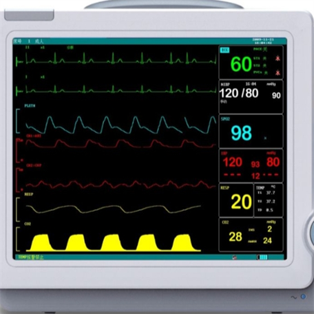 麻醉脑电监护仪哪些品牌更可靠？-图2