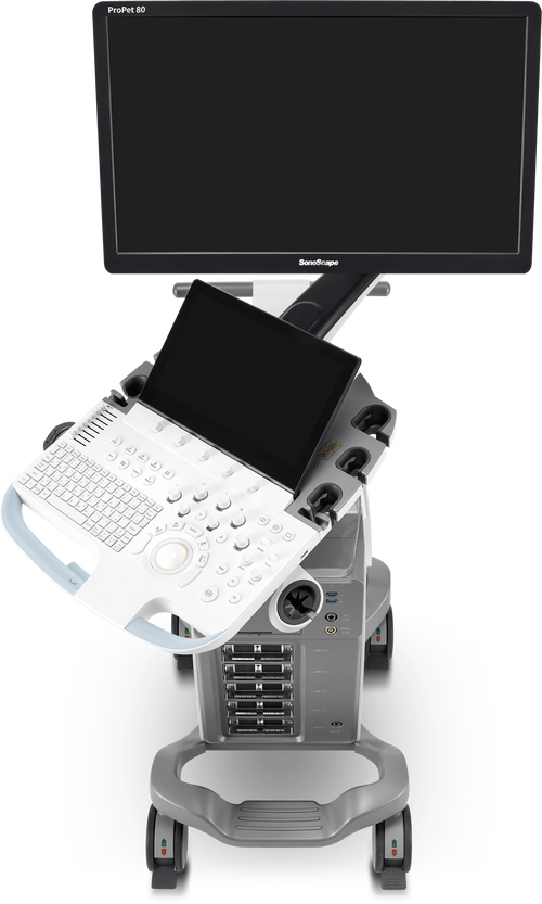 美国便携式超声仪有何优势或适用场景?-图1 美国便携式超声仪有何优势或适用场景?-图1