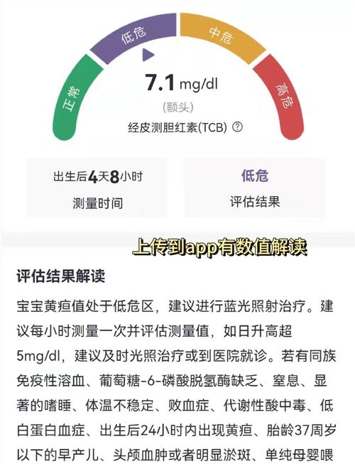 新生儿黄疸检测仪品牌怎么选?-图1 新生儿黄疸检测仪品牌怎么选?-图1