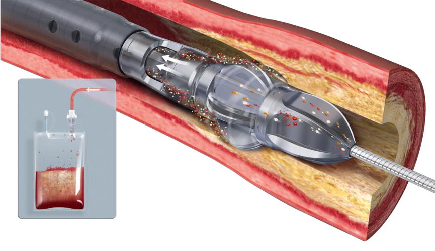 Buddy技术如何有效介入？-图2