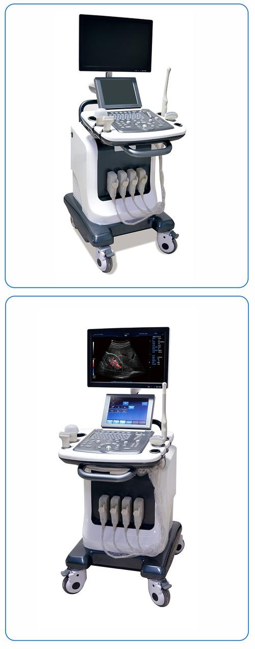 进口彩超机品牌怎么选?-图2 进口彩超机品牌怎么选?-图2