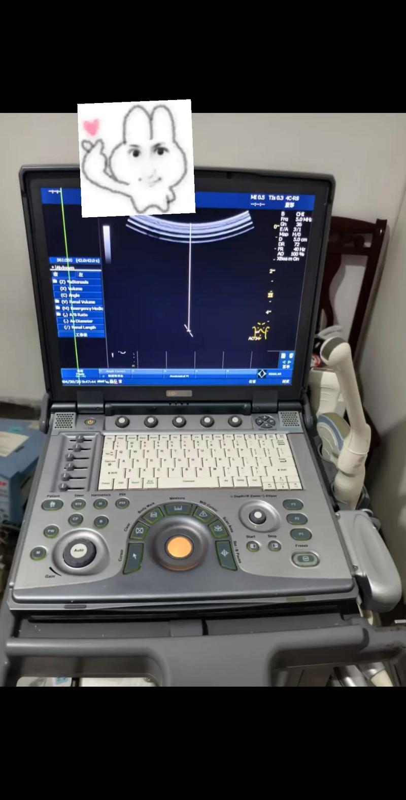 进口彩超机品牌有哪些？-图2