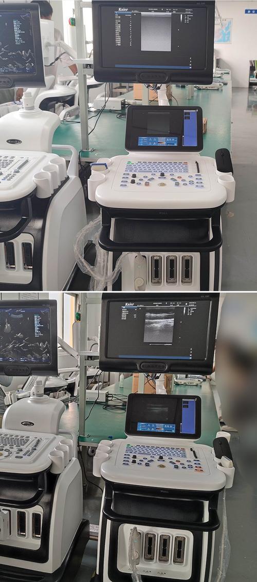 进口彩超机品牌有哪些？-图3