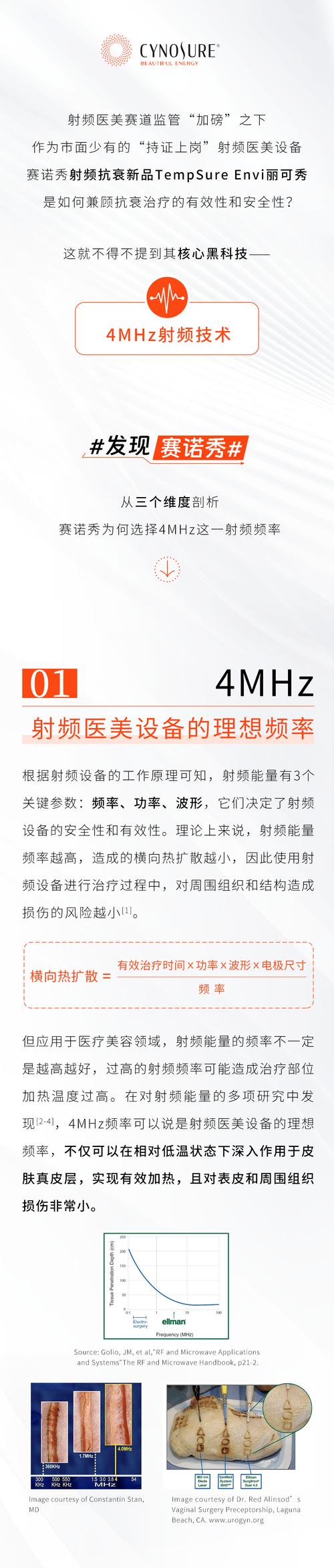 射频技术核心是什么？-图1