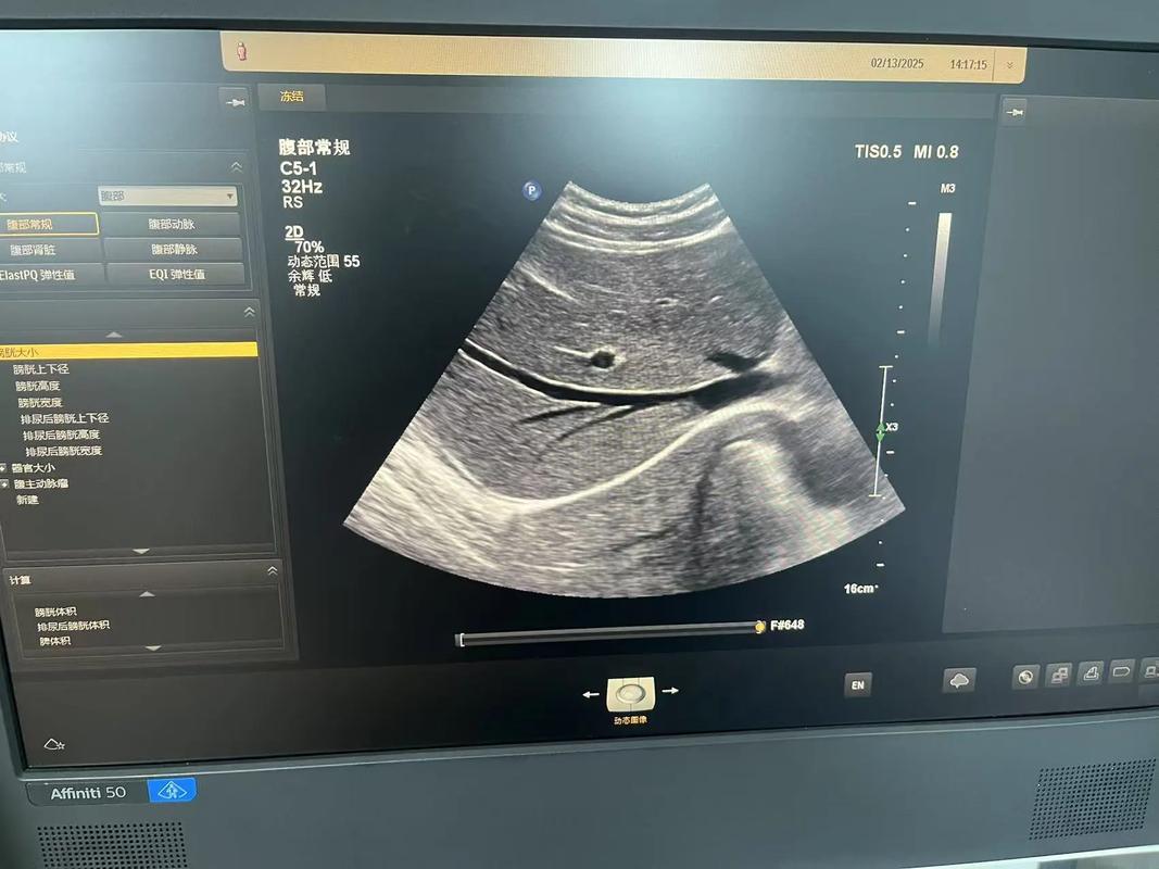 超声波探头品牌怎么选？-图1