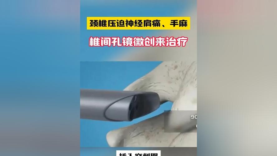 国产椎间孔镜刀头品牌哪家好？-图3